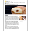 Monitoring Tools for a Potato Bruise Prevention Program