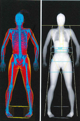 A dual-energy X-ray absorptiometry scan, which shows a participant's skeleton, is shown in the Human Performance Lab at the University of Idaho.