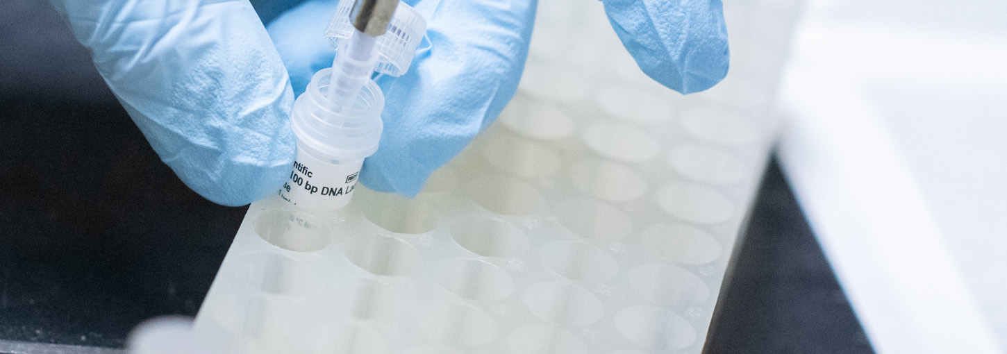 Hands in surgical gloves extracting DNA from vial with pipette