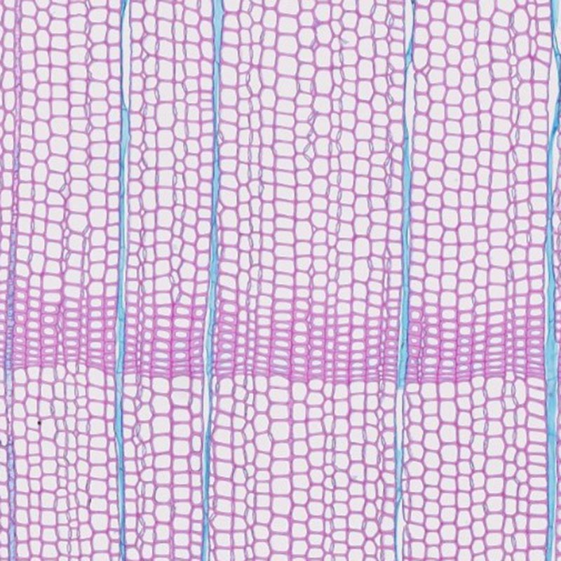 Tree cellular structure