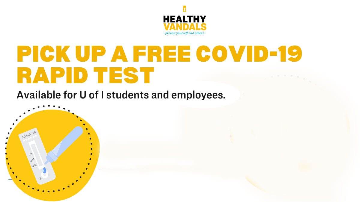 Pick up Monday - Friday, 12:00 - 2:00 p.m. at the Student Rec Center East Entrance. Must show VandalCard