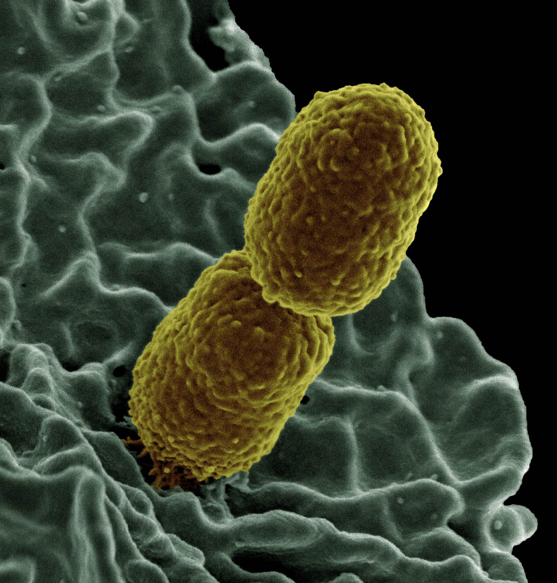 A yellow bacteria is connected to white blood cell.